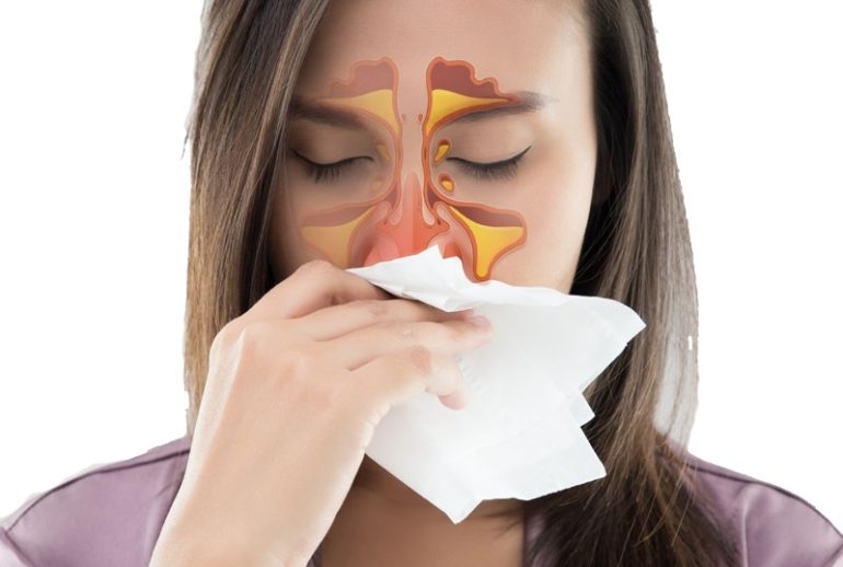 دکتر جراحی بینی و سینوس (رینولوژی) - شیراز